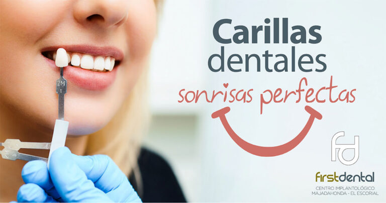 carillas dentales Firstdental