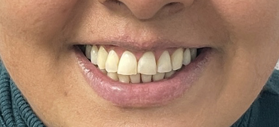 casos reales ortodoncia