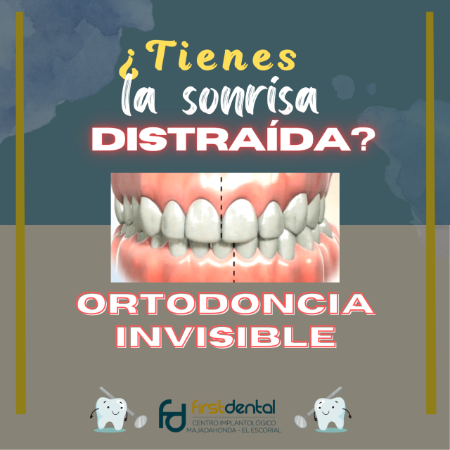 ORTODONCIA INVISIBLE TRANSPARENTE INVISALIGN